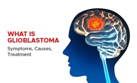 glioblastoma symptoms in adults